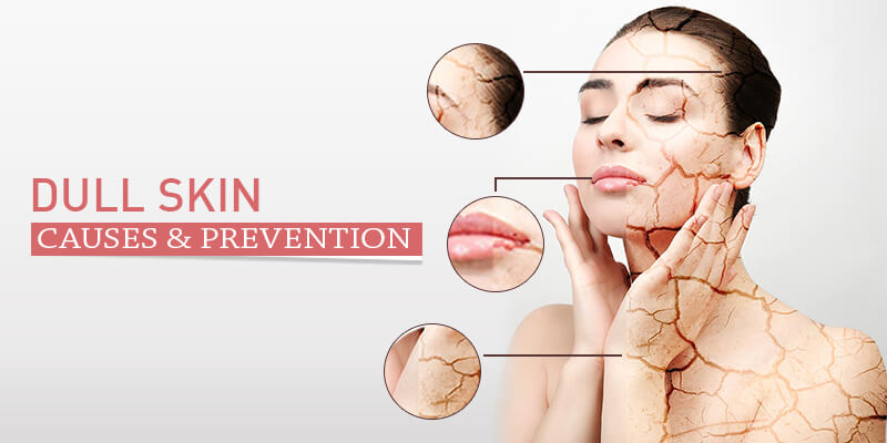 Dull-Skin-Causes-and-Prevention.jpg